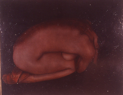 prone